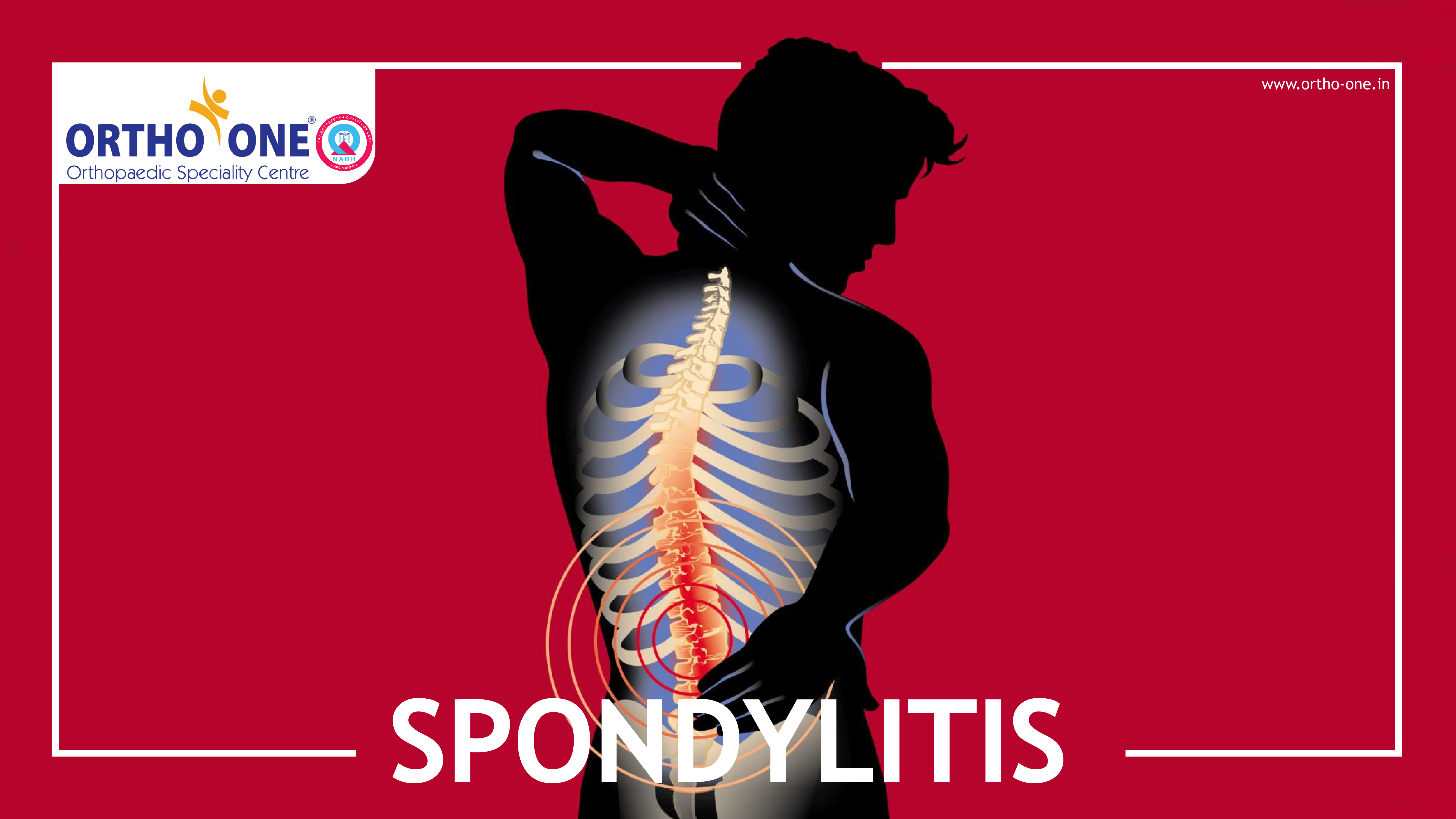 Spondylitis