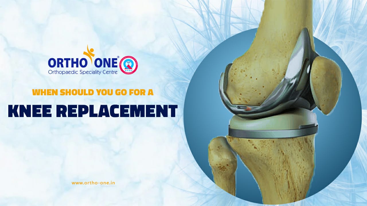 When Should You go for a Knee Replacement